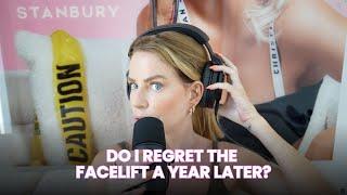 It's finally been 1 year since my facelift and this is my honest opinion...