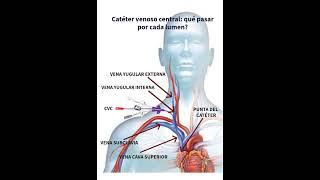 Catéter venoso central: qué pasar por cada lumen