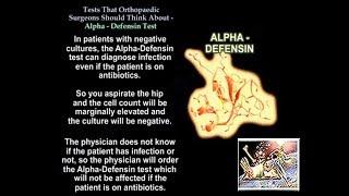 Alpha Defensin,Tests Ortho Surgeons Think About - Everything You Need To Know - Dr. Nabil Ebraheim