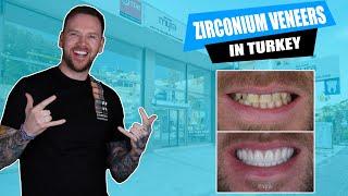 Getting Zirconium Veneers in Turkey | Review From Myra Dental Centre #veneers