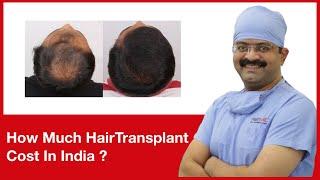 How Much Hair Transplant Cost In India | HairMD, Pune