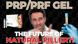 PRP / PRF GEL: The Future of NATURAL Filler?