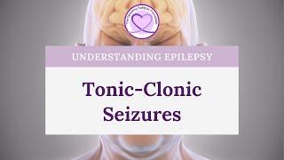 What are Tonic-Clonic Seizures?