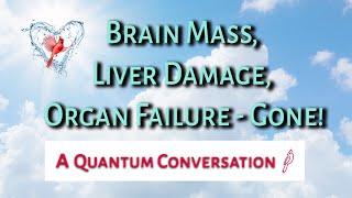 Brain Mass, Liver Damage, Organ Failure Gone!