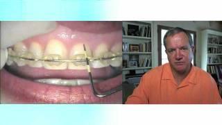 'Recession and Restorative Dentistry' Part 1