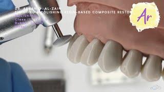 Finishing & polishing tools & application (2): Class III, IV, V composite restorations - Arabic عربي