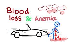 Blood Loss and Anemia - Hypovolemic shock - hemorrhagic shock - Causes of anemia