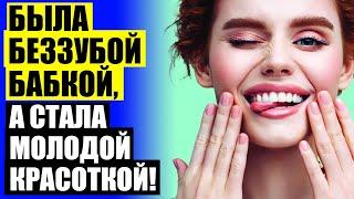  Где купить виниры на зубы ⭐ Виниры сыктывкар 