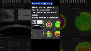 Types of AS-OCT scans and when to use them.