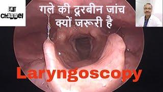 गले की दूरबीन जांच क्यो ज़रूरी है। What is fiber optic Laryngoscopy? Why endoscopy of throat ??