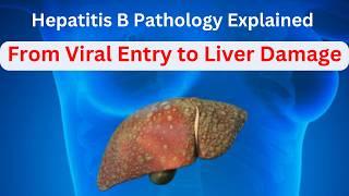 Hepatitis B Pathology. Explained From Viral Entry to Liver Damage