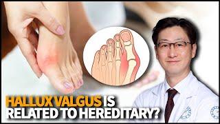 Is Hallux Valgus (Bunions) related to hereditary? What is Hallux Valgus and how can we treat it?