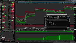 VWAP Z-Score Strategy Settings Walkthrough - Thinkorswim Tutorial