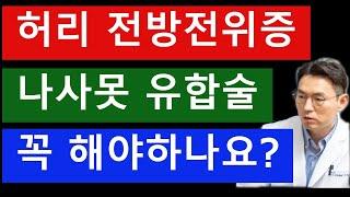 전방전위증  수술 -  나사못 유합술 꼭 해야 하나요?