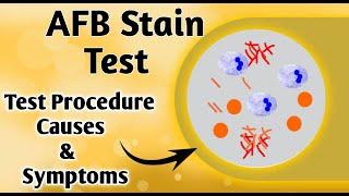 what is AFB I AFB stain procedure