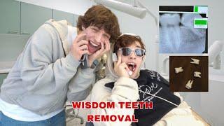 NICK GETS HIS WISDOM TEETH REMOVED!!