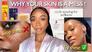 I WOULDN’T DO THESE TO MY SKIN !|Get Clear Skin with These Products, Nutrition Tips & Cycle Syncing