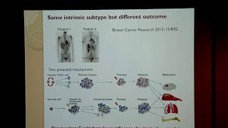 VTLSS: Evolving Concepts of Breast Heterogeneity and Impacts on Tumor/Metastasis Characterization