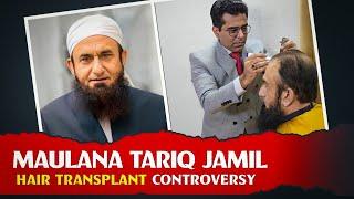 Maulana Tariq Jamil Hair Transplant Controversy  | Art of Living Podcast