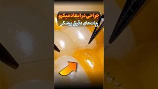 تکنولوژی ربات میکروسرجری؛ انقلابی در جراحی‌های دقیق پزشکی باقابلیت عملیات در ابعاد کمتر از 1 میلیمتر