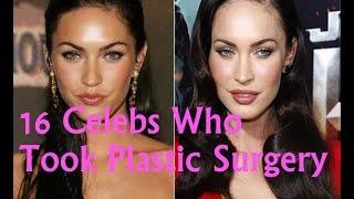 Celebrity Gossip-16 Celebs Who Took Plastic Surgery Too Far