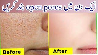 How to get rid of open pores on face, minimize large open pores instantly