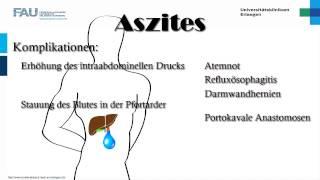 Innere Medizin ─ Aszites