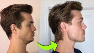 How I Fixed My Side Profile