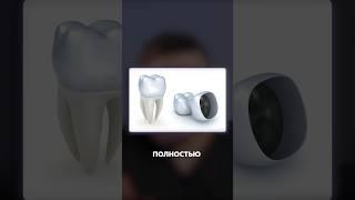 Коронка или пломба? Полный гайд! #здоровьезубов #dentist #зубы #пломба #коронканазуб