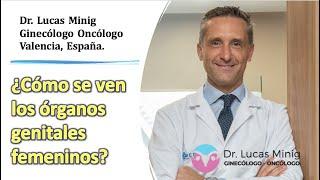 ¿Cómo se ven los órganos genitales femeninos? Dr Lucas Minig, Ginecólogo Oncólogo Valencia, España.