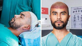 I Went To Turkey For A Hair Transplant