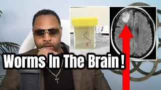 Scientists prove parasitic worms in the brain (mind control exposed)