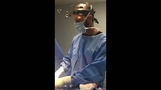 Breast Augmentation with Lift and Pocket Reconstruction with Mesh by Dr. Michael Rossi