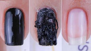 Remoção de Esmaltação em Gel em Unhas Naturais