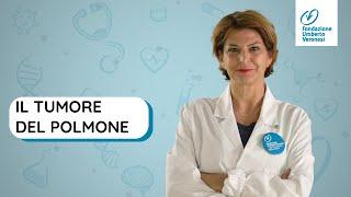 Tumore ai polmoni: sintomi, fattori di rischio, cure, ricerca