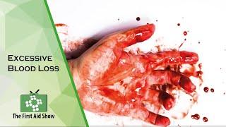 Excessive Blood Loss