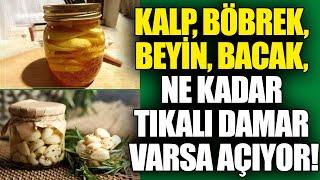 Kalp, Böbrek, Beyin, Bacak, Ne Kadar Tıkalı Damar varsa Açıyor!