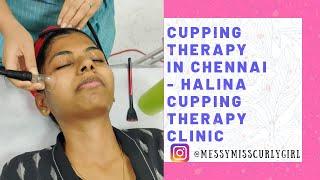 Cupping Therapy in Chennai - Glowing Skin Secret