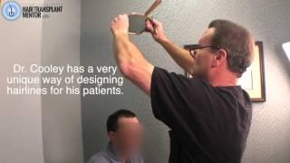 FUE Hair Transplant Repair Documentary Dr. Cooley Part 2