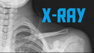 How does x-ray work? (AKIO TV)