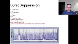 Amplitude integrated EEG aEEG made easy