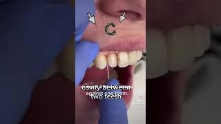 How to floss your teeth!