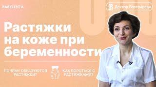 Растяжки при беременности, во время беременности. Как избежать? Когда появляются? Как убрать?