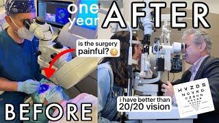 I had laser eye surgery at the best clinic in London - 1 year review (SMILE surgery)