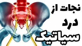 راه های جلوگیری و درمان ابتلا به درد سیاتیک/ دکتر نکته#دکترنکته