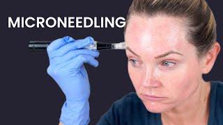 Microneedling NECK and CHEST with Dr Pen M8S, Tightening my old skin at home.