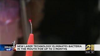 Laser technology could help eliminate bacteria in your mouth