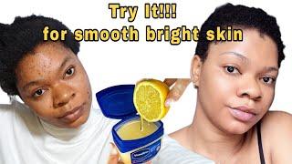 How to get smooth bright skin at home, Use Vaseline and lime for bright skin #skincare #acne #scar