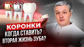 Коронки: ГРОБ для зубов или вторая жизнь? Когда пора устанавливать? Какие выбрать?