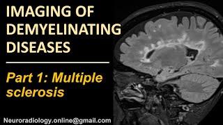 Imaging of Multipe Sclerosis